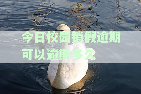 今日校园销假逾期可以逾期多久
